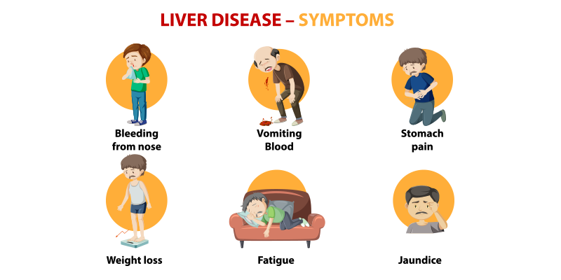 Signs and Symptoms of Fatty Liver Disease